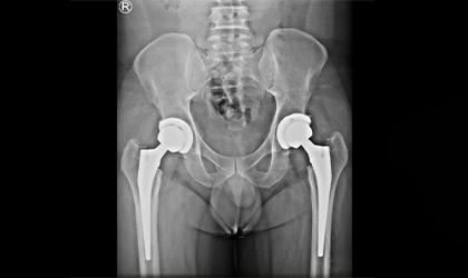 Sports Injury Case Study